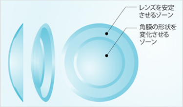 オルソケラトロジー用ハードコンタクトレンズ