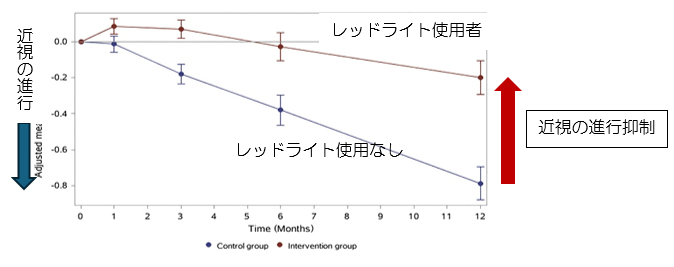 レッドライト治療のデバイスについて